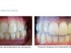 guia33-cornella-clinica-dental-clinica-dental-dra-mariana-sacoto-cornella-15934.jpg