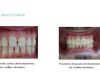 guia33-cornella-clinica-dental-clinica-dental-dra-mariana-sacoto-cornella-15936.jpg
